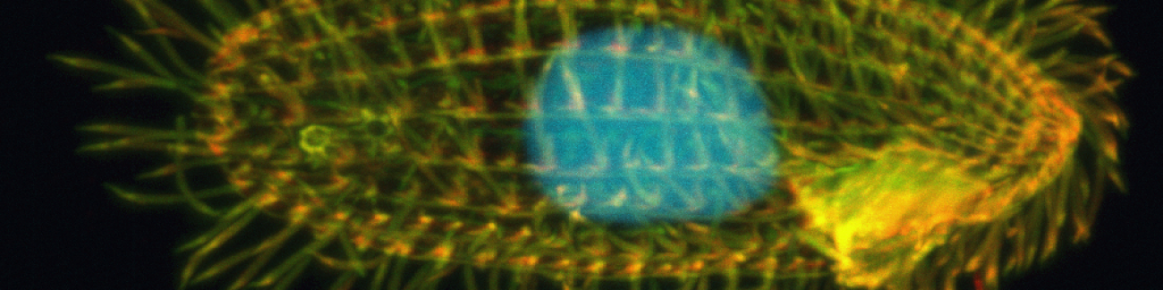 Tetrahymena thermophila, a single-celled organism studied by Suzanne Lee, with a yellow body and blue center under the microscope