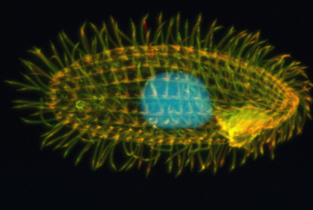 Tetrahymena thermophila, a single-celled organism studied by Suzanne Lee, with a yellow body and blue center under the microscope